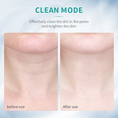 Neck Face Beauty Device LED Photon Therapy Reduces Double Chin